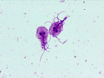Photos Of Protozoa